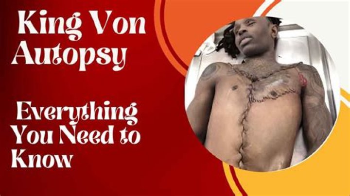 King Von Autopsy Released: Full Details Revealed You Won&rsquo;t Believe