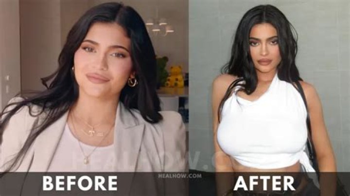 Kylie Jenner Weight in kg 2024: Everything You Need to Know