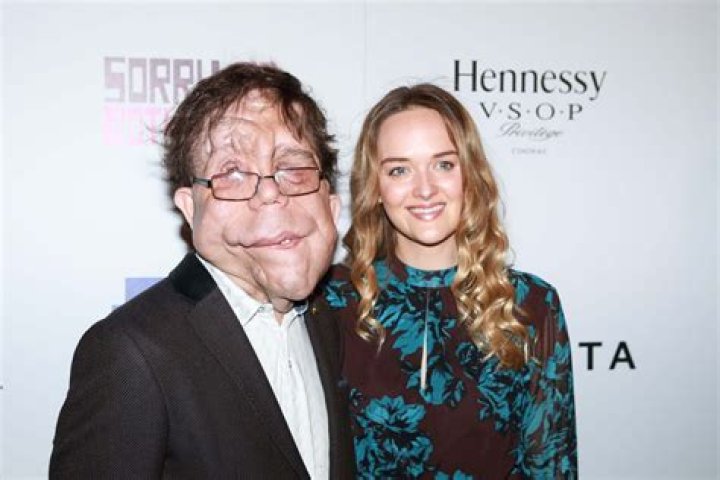 Understanding Adam Pearson's Girlfriend: A Deep Dive into His Personal Life